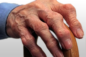 Causes Of Arthritis