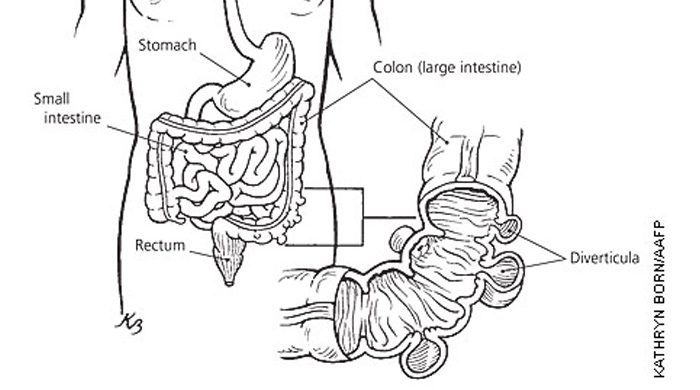 Colon Cleansing