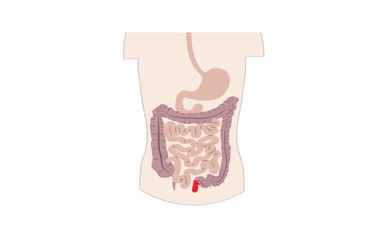 Crohn's Diet Treat And Prevent Crohn's Disease With A Whole Food Plant-Based Diet