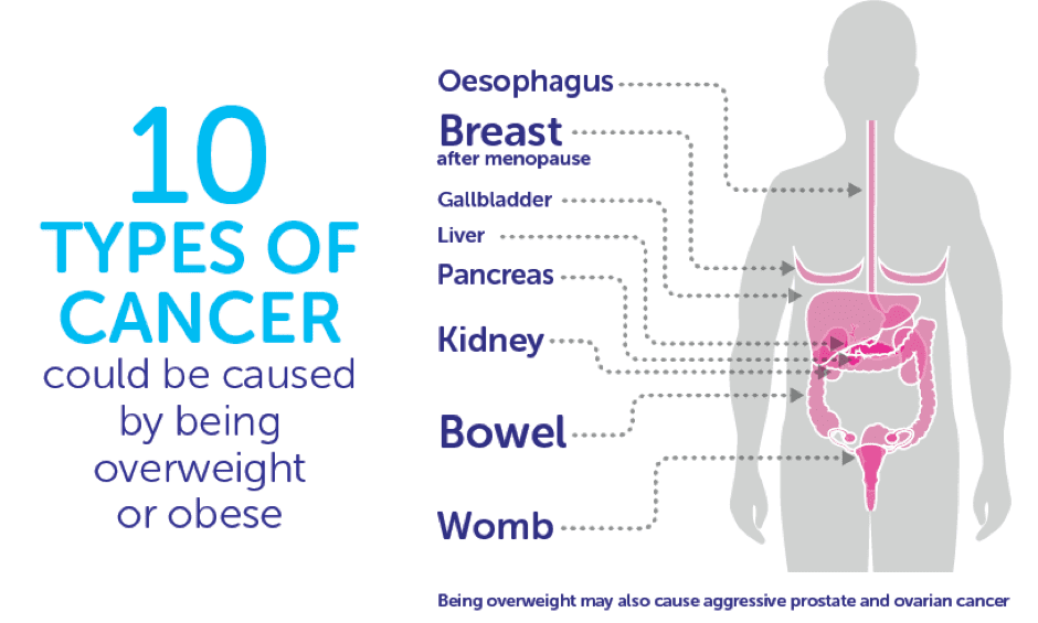 Obesity Associated With Increased Risk Of Cancer