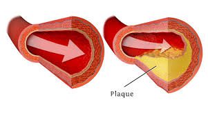 Vegans And Everyone Know Vitamin B12 Is Essential For Arterial Health