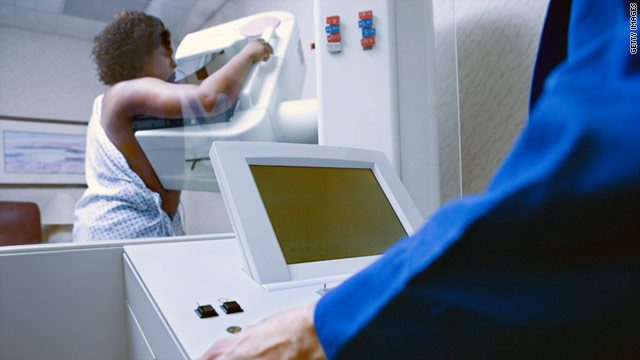 Study Shows CAD Mammograms Don't Offer Improved Cancer Detection