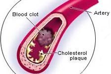 What is Cholesterol? Cholesterol Benefits