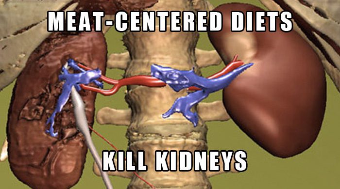 A Meat And Dairy Acidic Diet Kills Your Kidneys And Here's The Science To Prove It