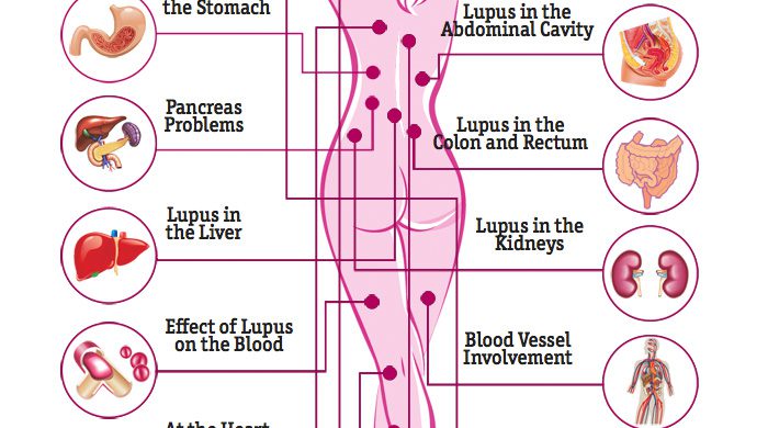 Turmeric Fight Kidney Damage Caused By Lupus