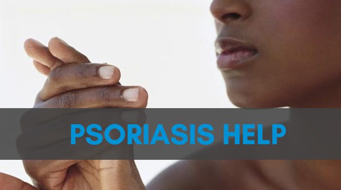 Helping Psoriasis With An Alkaline Plant Based Diet And Herbs