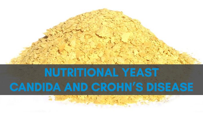 Nutritional Yeast Is A Trigger For Chrohn's Disease